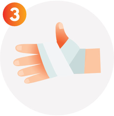 burns first aid step 3 Cover the burn